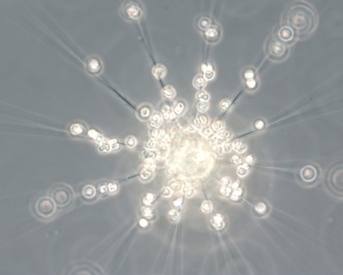 Phaeocystis cells freshly attached to the spines of a diatom
