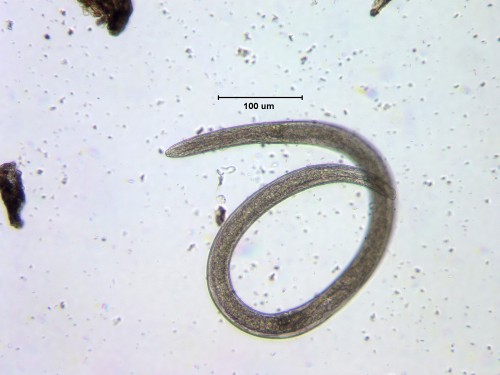 A nematode worm is extracted from tundra soil near Toolik Lake.