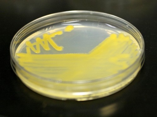 Petri plate containing bacteria harvested from amoebae.